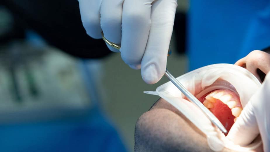 Zubař při stomatologickém zákroku – pacient s otevřenými ústy a bílým plastovým rozvěračem, zubař v rukavicích pracuje s dentálním nástrojem